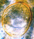 Endogone spore