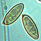 Gastroboletus spores