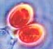 Gastrocybe spores