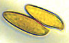 Gastroleccinum spores