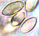 Gastrosuillus spores