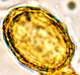 Hydnotryopsis spore
