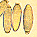 Hysterangium spore