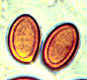 Nivatogastrium spore