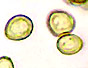 Protubera spore