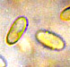 Rhizopogon spore
