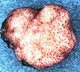 Ruhlandiella sporocarp