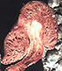 Setchelliogater sporocarp