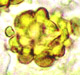 Spaerosoma spore