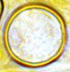 Stephensia spore