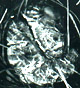Stephensia sporocarp